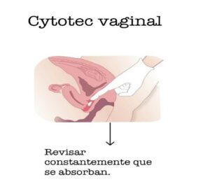 cytotec-vaginal